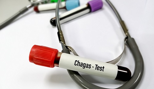 Tratamiento de la enfermedad de Chagas